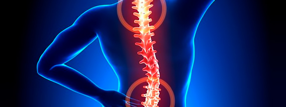 Боли в спине