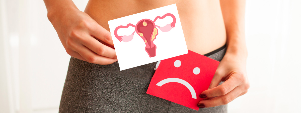 Миома матки