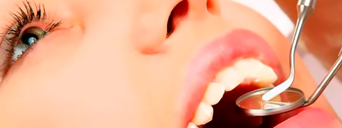 Пародонтоз